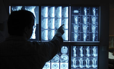 Perform AI-Driven Medical Imaging Efficiently and Cost-Effectively on Intel® CPU–Based Systems